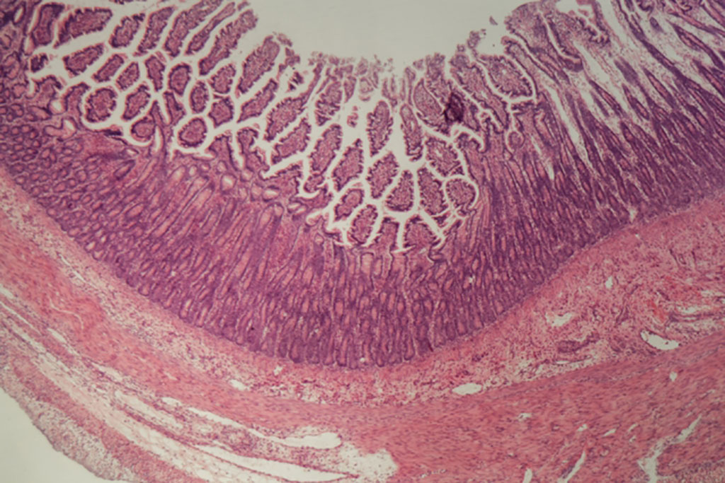 intestinal image 